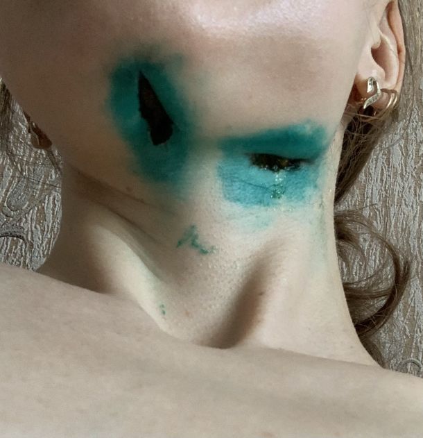 Відгуки про “Apple Dent, стоматологічний центр” - фото 1