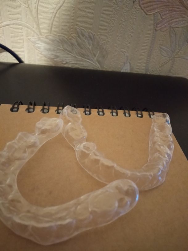 Відгуки про “Denta Super, стоматологічна клініка” - фото 1