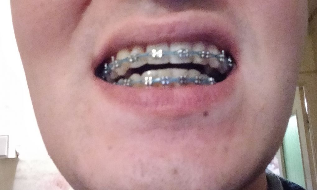 Відгуки про “Абі Дент, стоматологічний центр” - фото 2