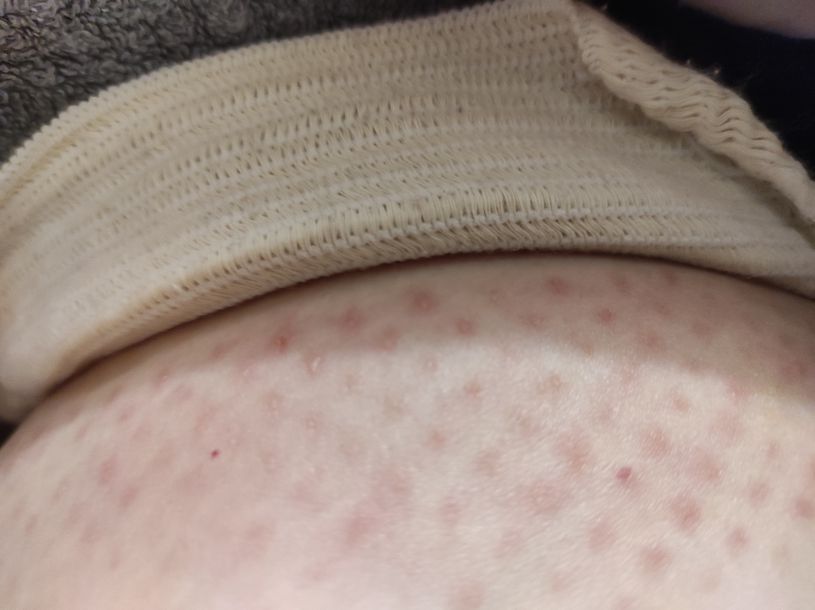 Відгуки про “Medi, мережа ортопедичних салонів” - фото 1