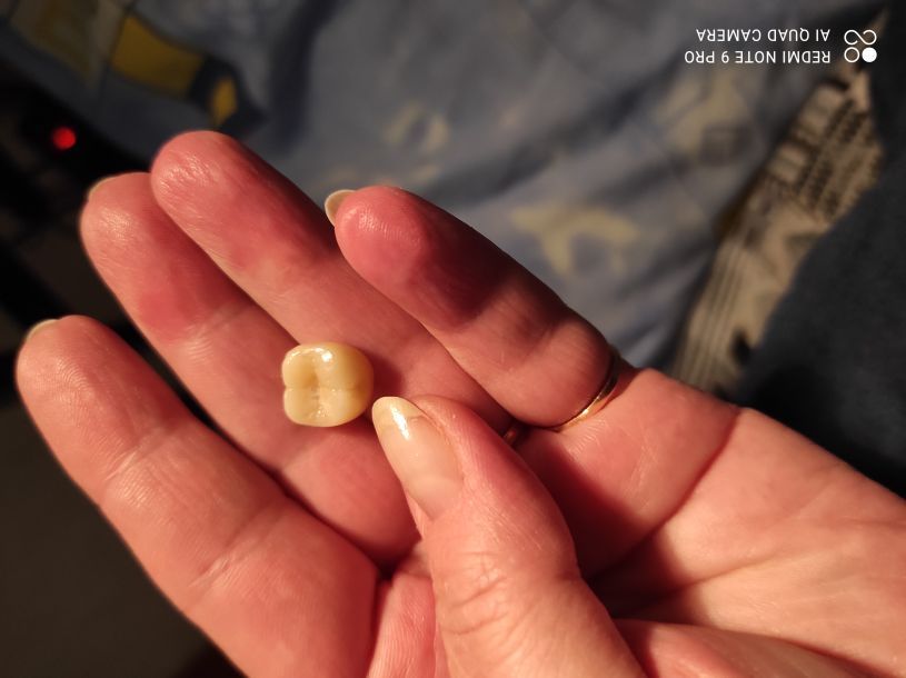 Відгуки про “ПрезиДент, стоматологія” - фото 1