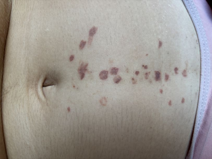 Отзывы о “Tk laser, лазерная эпиляция” - фото 1