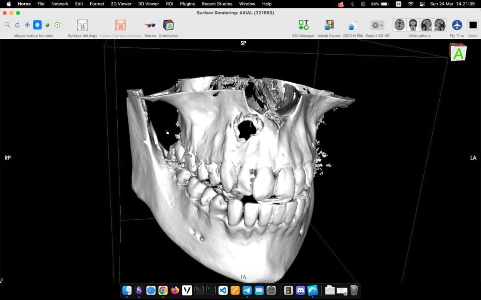 Отзывы о “Lucky Dent, стоматологический центр” - фото 1