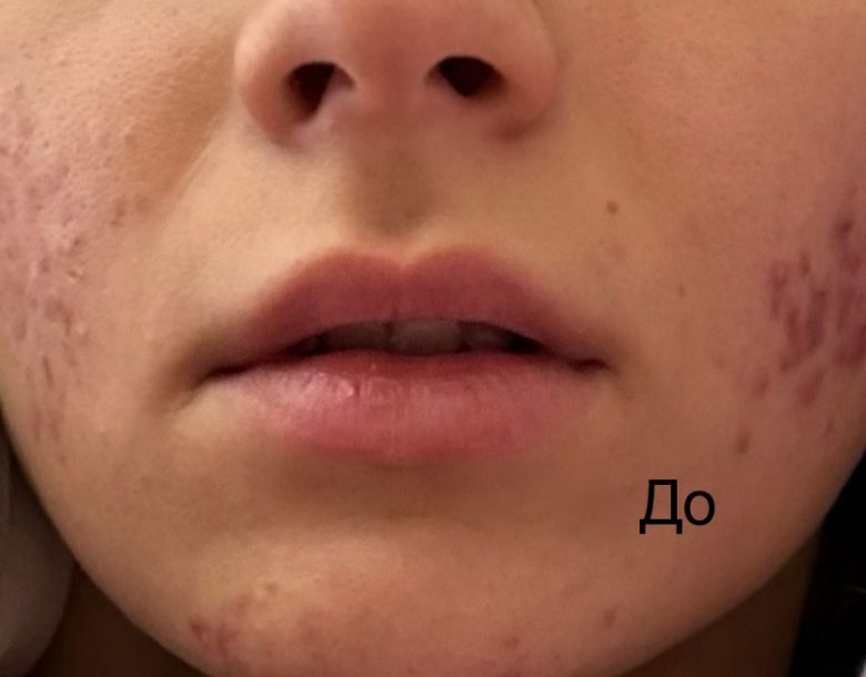 Відгуки про “Beauty Art, центр пластичної хірургії” - фото 1