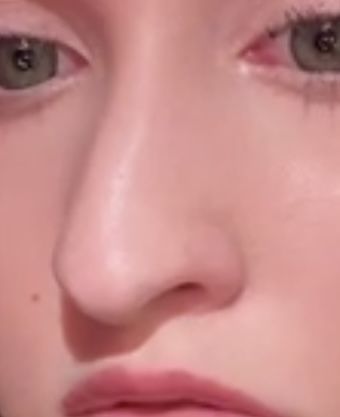 Відгуки про “Лор, клініка Стахіва” - фото 1