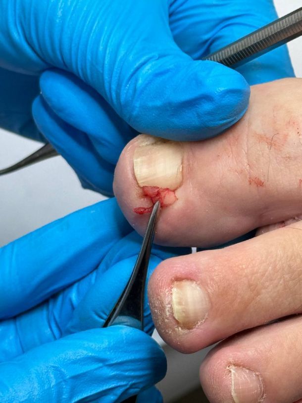 Відгуки про “Podopractice, подологический центр” - фото 1