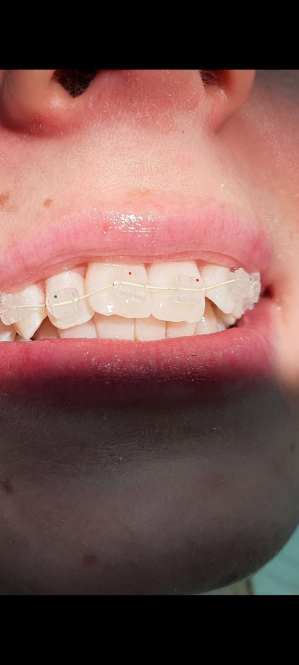 Відгуки про “La Minta, стоматологічна клініка” - фото 1