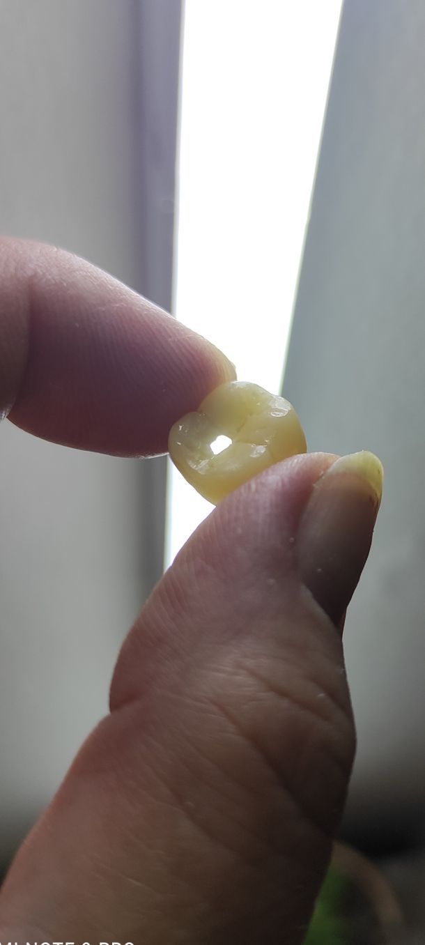 Відгуки про “ПрезиДент, стоматологія” - фото 1