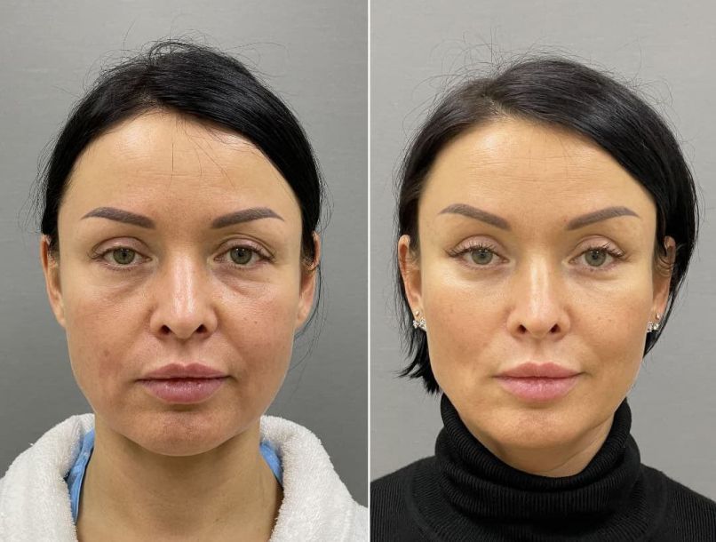 Відгуки про “Lunaris clinic, центр естетичної медицини” - фото 1