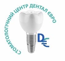 Dental Euro, стоматологія фото