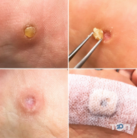 отзывы о Подолог Здорова Стопа фото