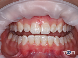 ViDident Clinic, стоматологический центр - фото 9