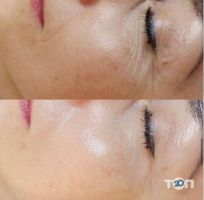 Ag skin отзывы фото