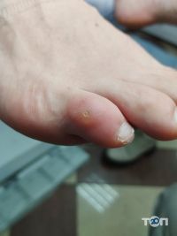Подолог Яна Верстюк Черновцы отзывы фото