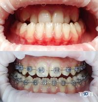 компанія NeoDent фото
