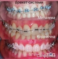 Стоматолог-ортодонт Теслюк Олена Михайлівна - фото 8