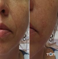 Ag skin, косметология фото