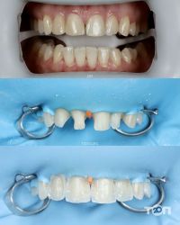 отзывы о Yeremchuk Dental фото