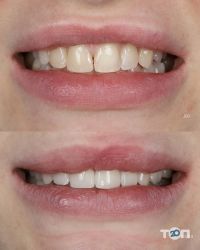 Стоматологии Yeremchuk Dental фото