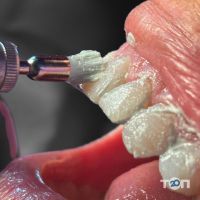 Yeremchuk Dental Черновцы фото