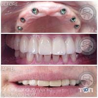 Люмі-Дент, стоматологія - фото 14
