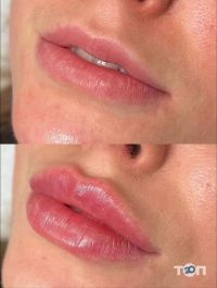 Beauty Line Запорожье отзывы фото