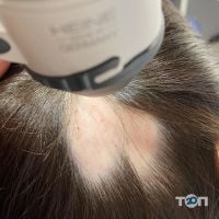 Hair Help, клиника трихологии и дерматологии фото