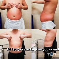 Mada, центр коррекции фигуры фото