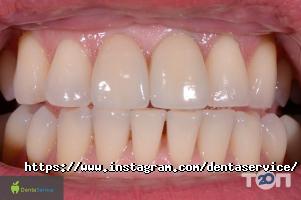DentaService відгуки фото