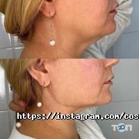 Анатомия Астана фото