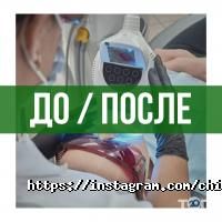 Chibis відгуки фото