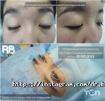 RB clinic отзывы фото