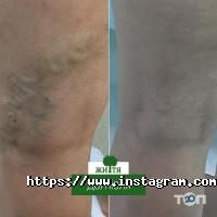 відгуки про Життя фото