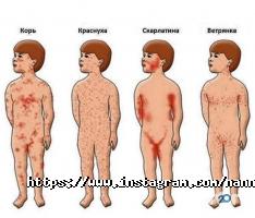 Kiddy відгуки фото