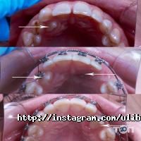 Усмішка Одеса фото