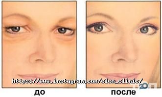 Ел.Ен Київ фото