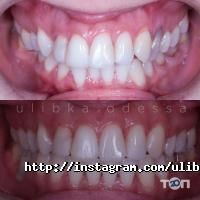 відгуки про Усмішка фото