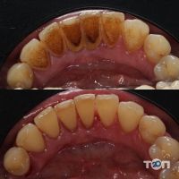 Стоматологічний кабінет Сови Наталії Дніпро фото