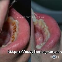 Vіvadent відгуки фото