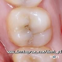 Дент + Івано-Франківськ фото