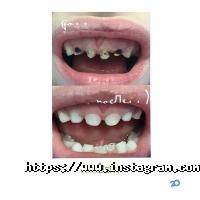 Lekadent, стоматологія фото