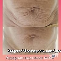Косметологічні клініки Top Laser фото