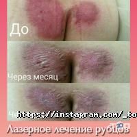 відгуки про Top Laser фото