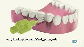 Стоматології Дент + фото