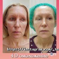 Top Laser Київ фото