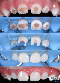 ДентХаус, стоматология - фото 9