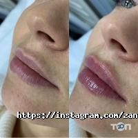 відгуки про Zanneli фото