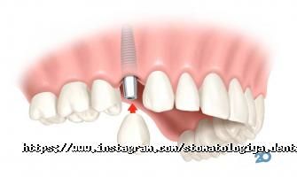 Dentis Київ фото