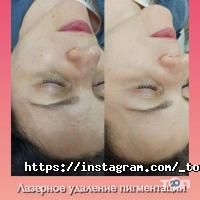 Top Laser Київ фото