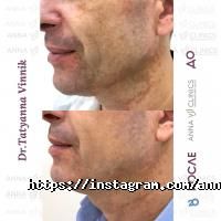 Anna Vi Clinics  отзывы фото